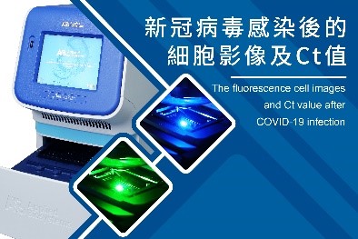 The fluorescence cell images and Ct value after COVID-19 infection