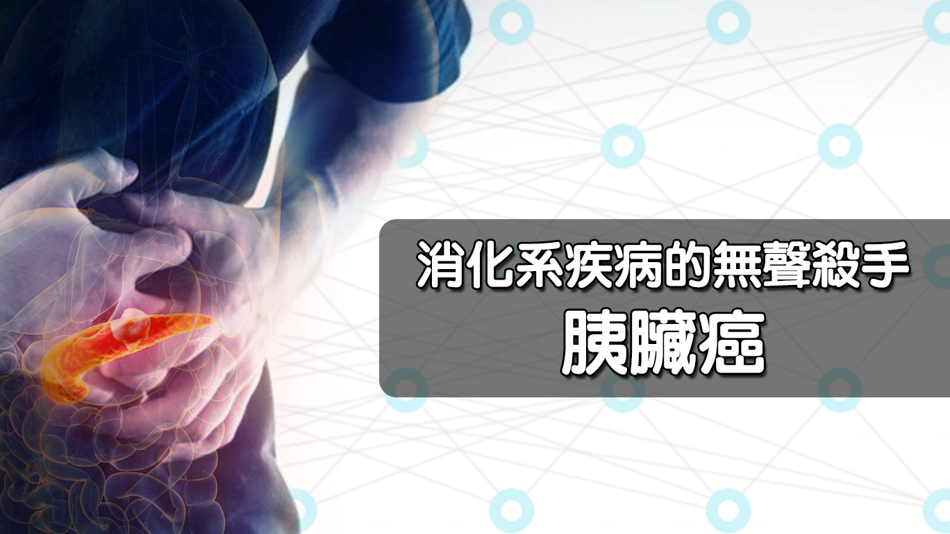 消化系疾病的無聲殺手 - 胰臟癌