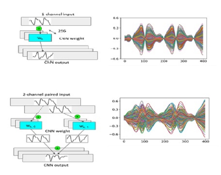 AI and Non-invasive Blood Glucose Measurements
